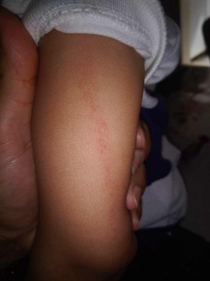 Mersin'de Kreşte 3 Yaşındaki Çocuk Darp Edildi