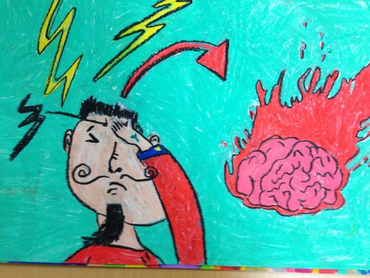 Çocuklarda Migren Nasıl Anlaşılır?