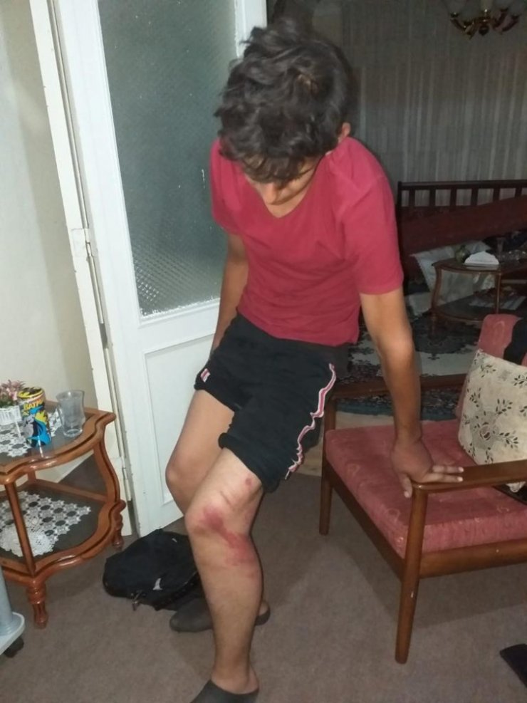Konya'da Çırağını Triger Kayışıyla Döven Usta Tutuklandı