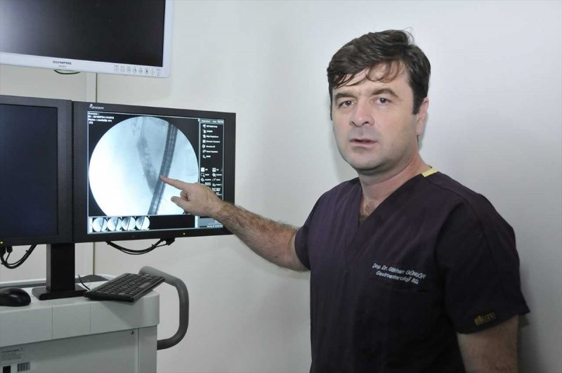 Safrasından 100'den Fazla Taş Ameliyatsız Çıkarıldı