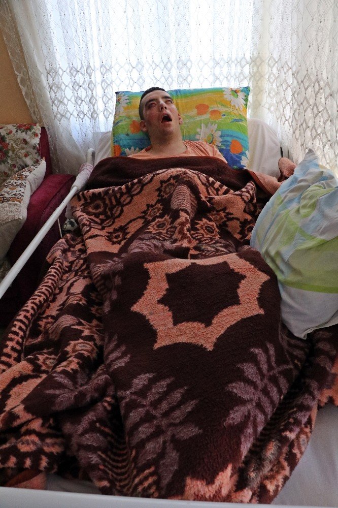 5 Yıldır Gözlerini Kırpamıyor, Adeta Kan Ağlıyor