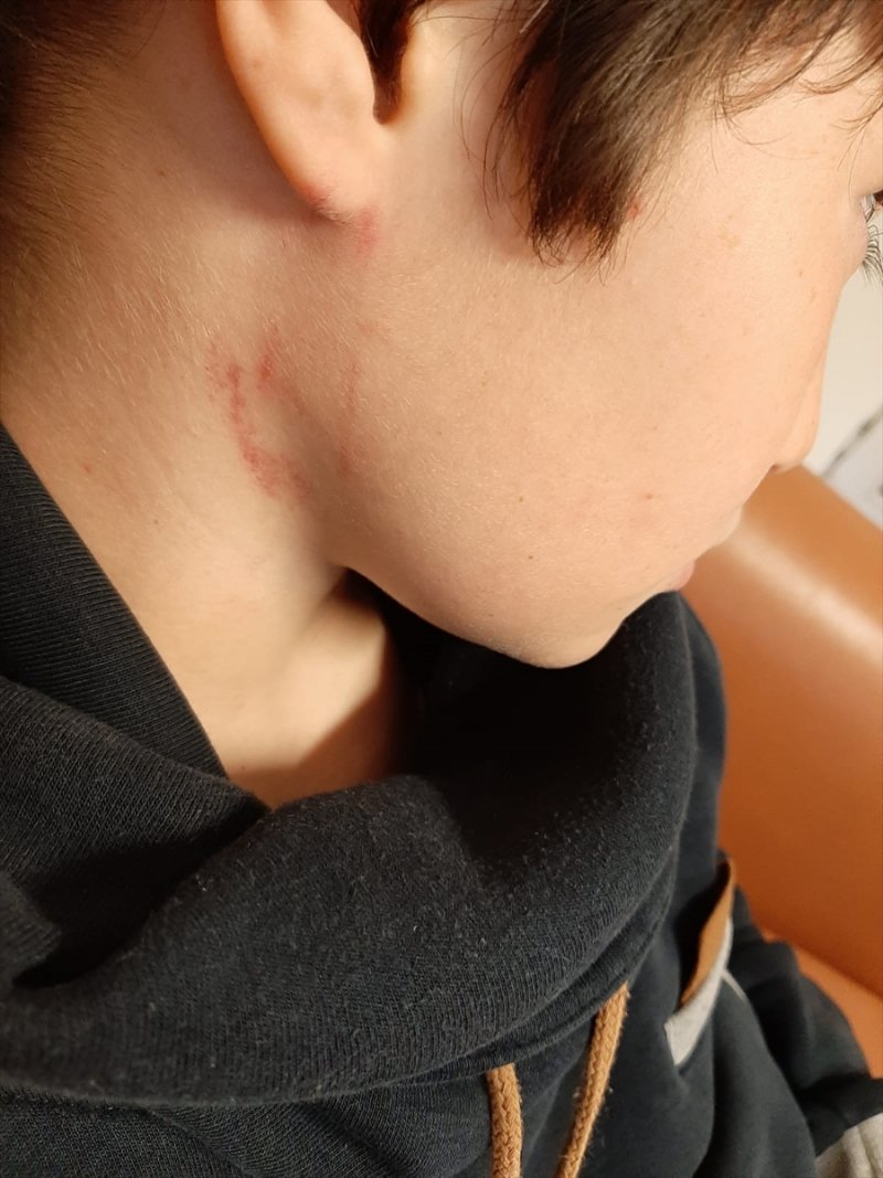 Kaynaştırma Öğrencisini Dövdüğü İddia Edilen Öğretmen Hakkında Soruşturma