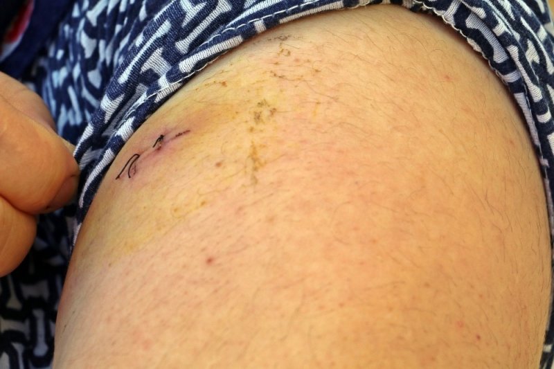 Antalya'da Eşini Bıçaklayan Kocanın Cezası Belli Oldu