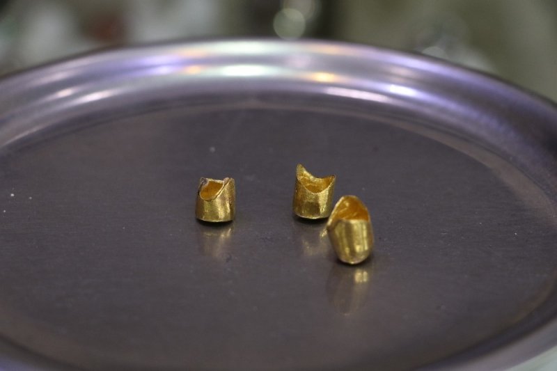 Antalya'da Kuyumcu Sahte Altın Diş İle Dolandırıldı