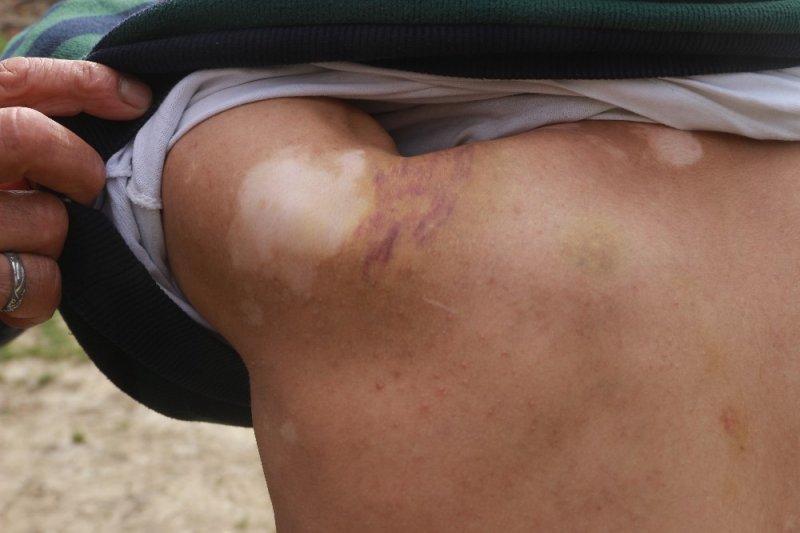 Mut’ta Engelli Genç Darp Edildi