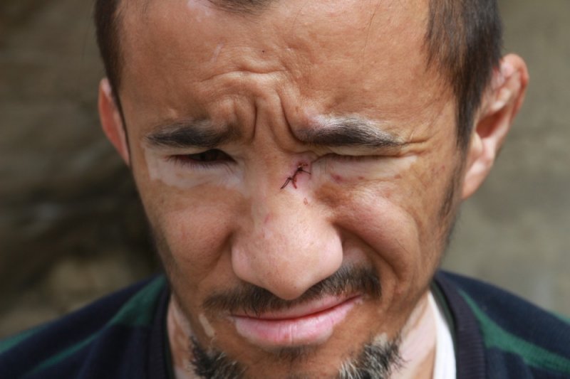 Mut’ta Engelli Genç Darp Edildi