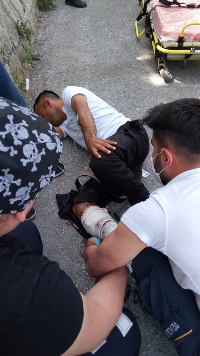 Kayseri'de Silahlı Kavga: 1 Yaralı