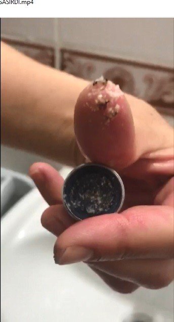 Musluk Filtresi Sinek Yuvası Olmuş