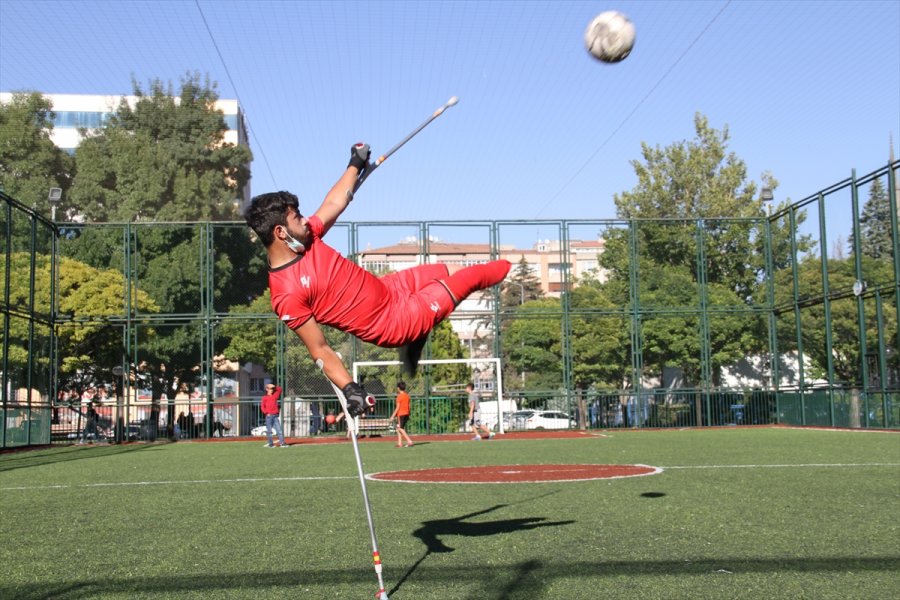 Kazada Bir Ayağını Kaybeden Ampute Futbolcunun Milli Takım Hayali