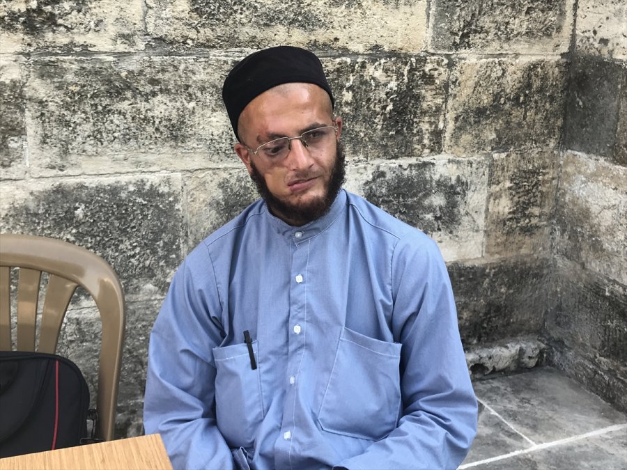 Yüzündeki Yara İzlerinden Kurtulup Çalışmak İstiyor