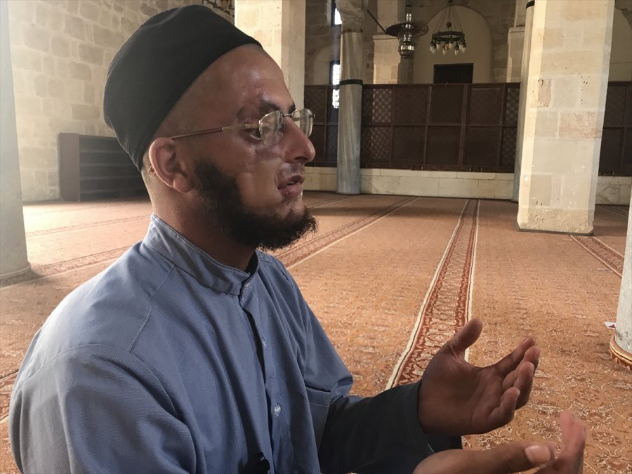 Yüzündeki Yara İzlerinden Kurtulup Çalışmak İstiyor