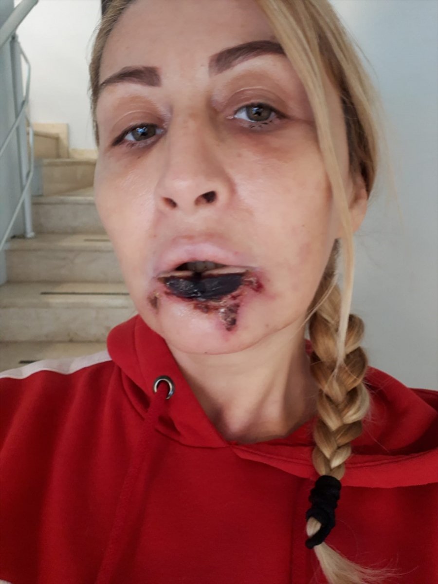 Estetik Mağdurlarını Görünce Her Seferinde Aynı Acıyı Yaşıyor