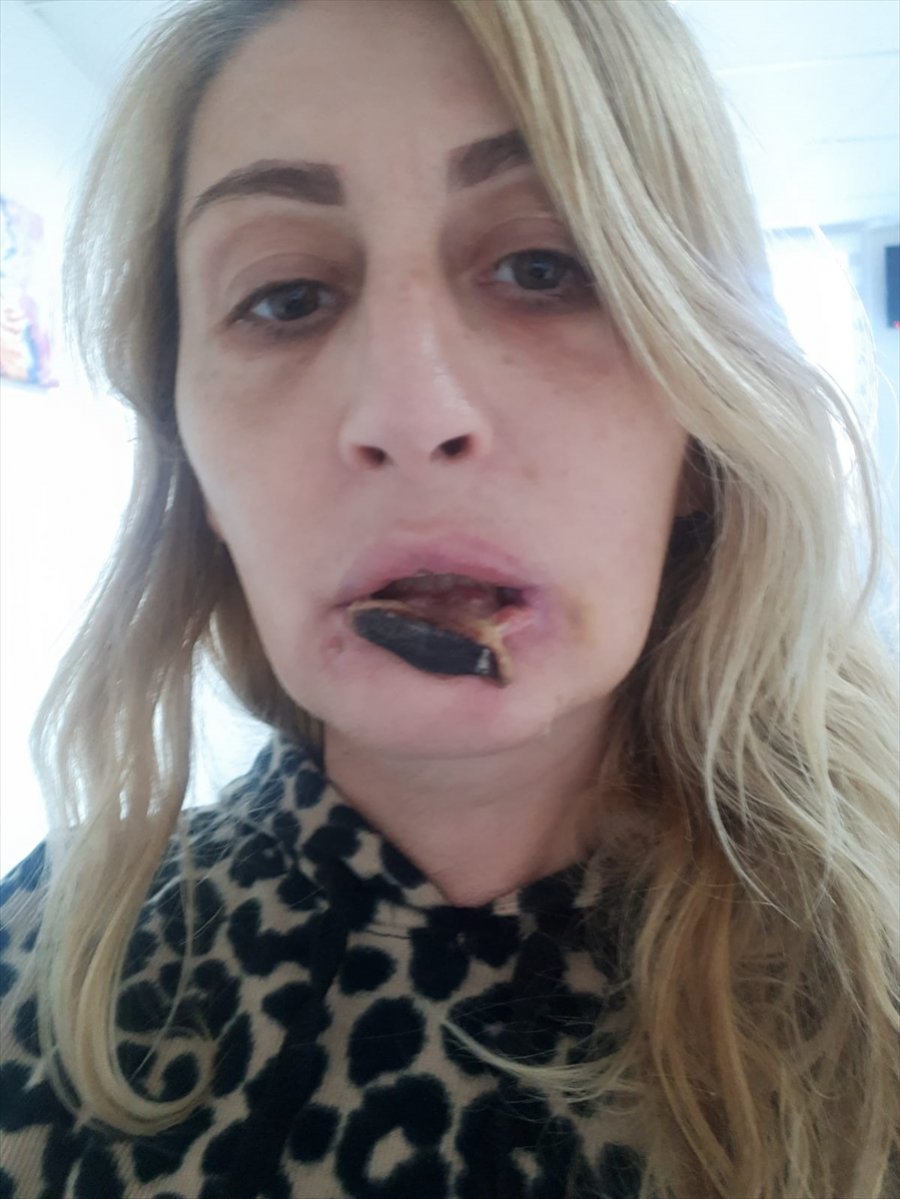 Estetik Mağdurlarını Görünce Her Seferinde Aynı Acıyı Yaşıyor