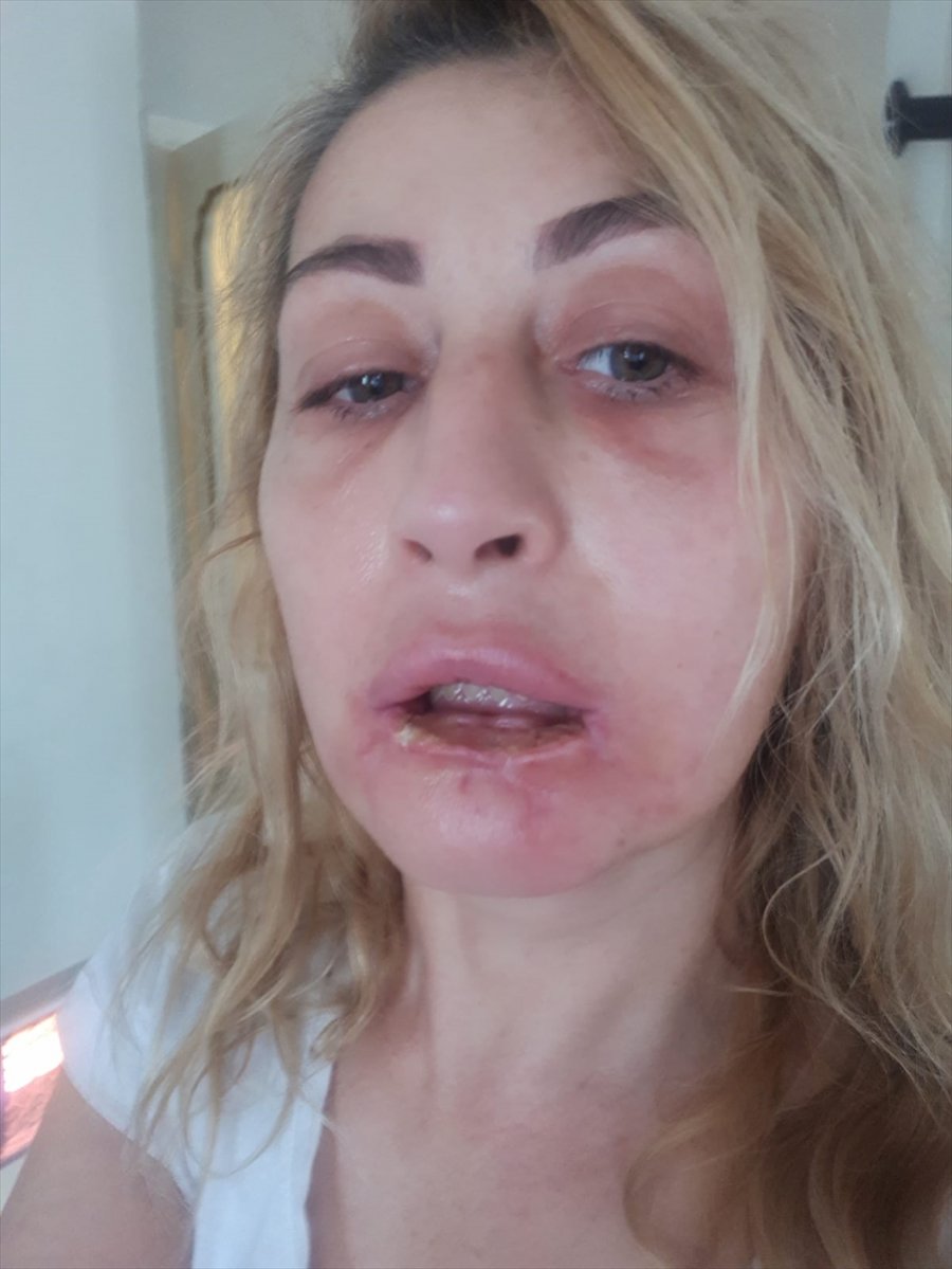 Estetik Mağdurlarını Görünce Her Seferinde Aynı Acıyı Yaşıyor