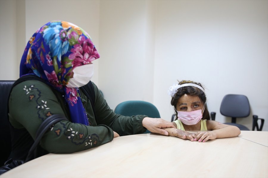 Suriyeli Küçük Hane'nin Yüzü Doku Nakliyle Güldü