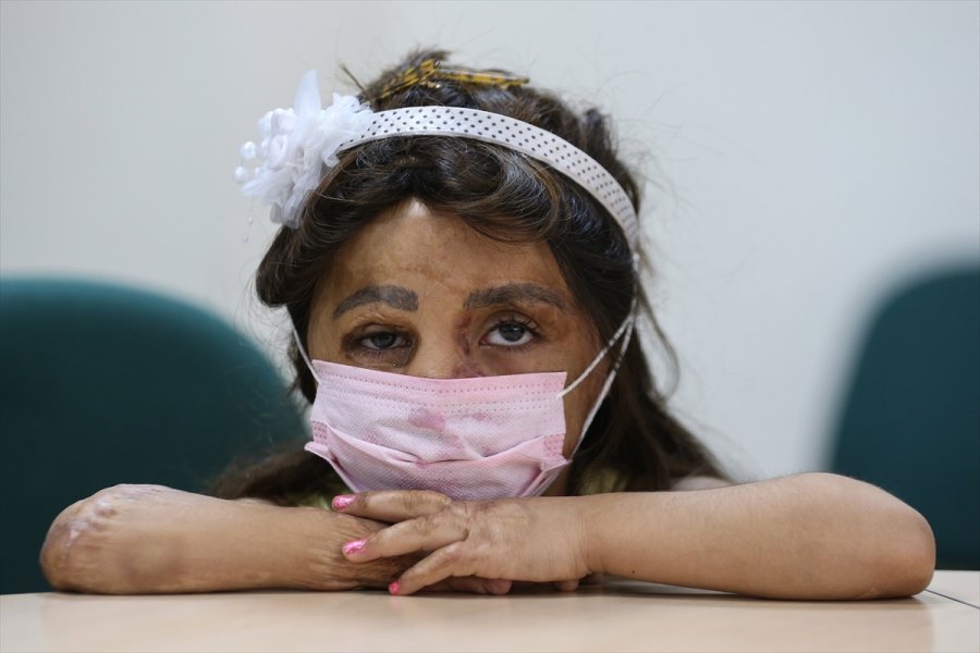 Suriyeli Küçük Hane'nin Yüzü Doku Nakliyle Güldü