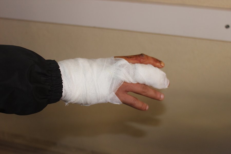 Karapınar'da Sokak Köpeğinin Saldırdığı Genç Yaralandı