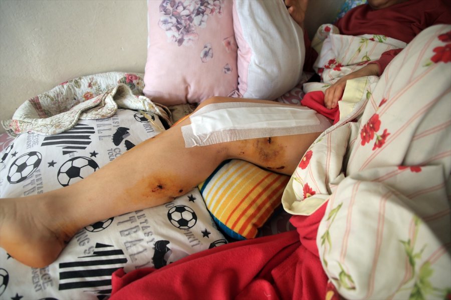 Mersin'de Boşanma Aşamasındaki Eşinin Silahlı Saldırısına Uğrayan Kadın Taburcu Edildi