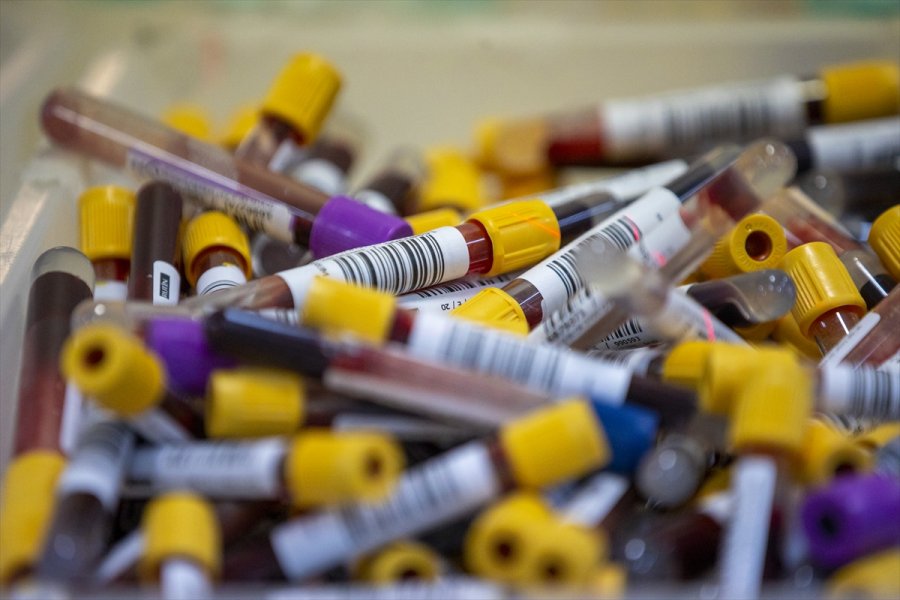 Kovid-19 Laboratuvarında Virüsün Tespiti İçin Zamanla Yarışıyorlar