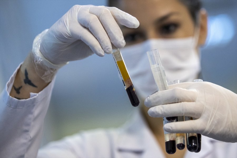 Kovid-19 Laboratuvarında Virüsün Tespiti İçin Zamanla Yarışıyorlar