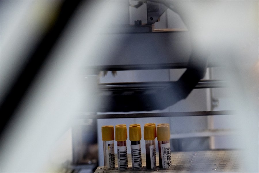 Kovid-19 Laboratuvarında Virüsün Tespiti İçin Zamanla Yarışıyorlar