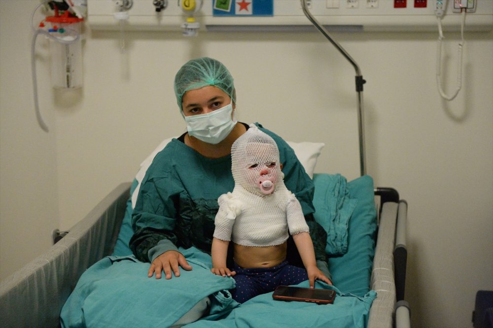 Afyonkarahisar'da Üzerine Sıcak Su Dökülen Bebeğin Eskişehir'de Tedavisi Sürüyor