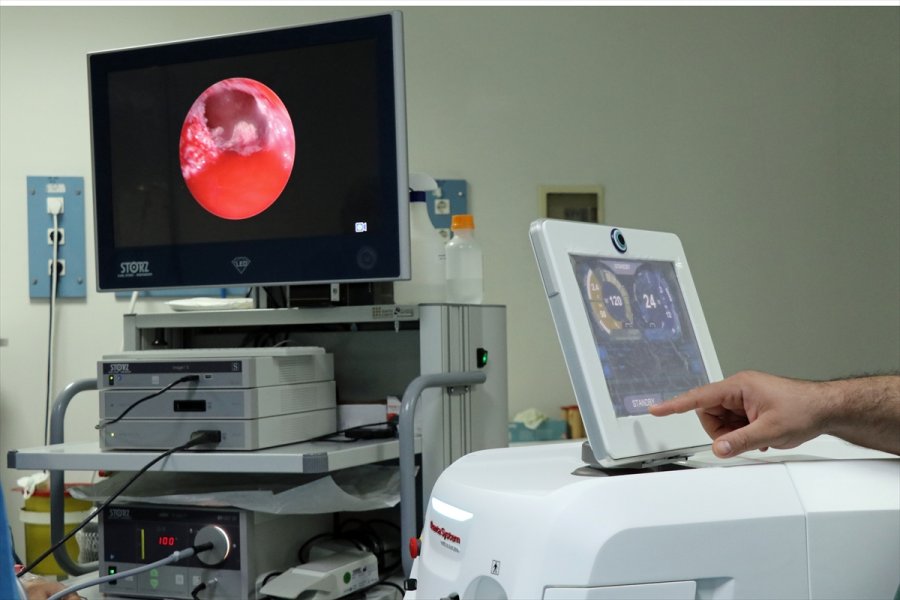 Erü'lü Profesörün Literatüre Kazandırdığı Teknik, Prostat Ameliyatlarında Hekimlerin İşini Kolaylaştıracak