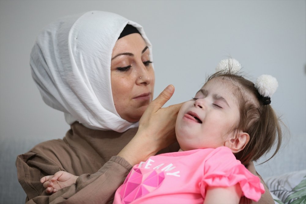 Mutluluklarının Adı Serebral Palsi Hastası Tek Yumurta İkizi Kızları Oldu