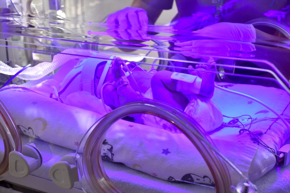 Kovid-19'a Yakalanan Kovid-19 Hamilelerde Erken Doğuma Sebep Oluyor mu?Erken Doğum Riski Var mı?