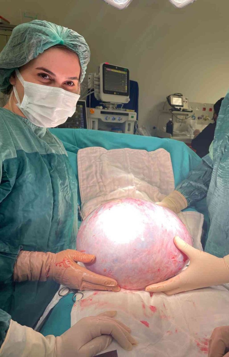 Karnından 9 Kilo Tümör Çıktı