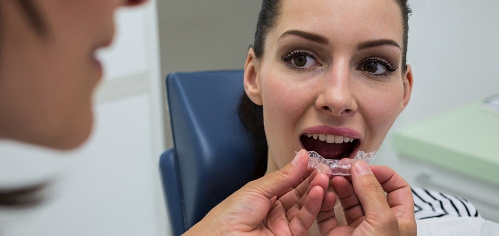 Diş Telleri Tarih Oluyor