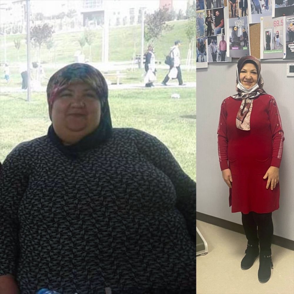 Aksaraylı Genç Kadın 95 Kilo Verdi