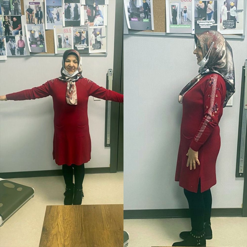 Aksaraylı Genç Kadın 95 Kilo Verdi