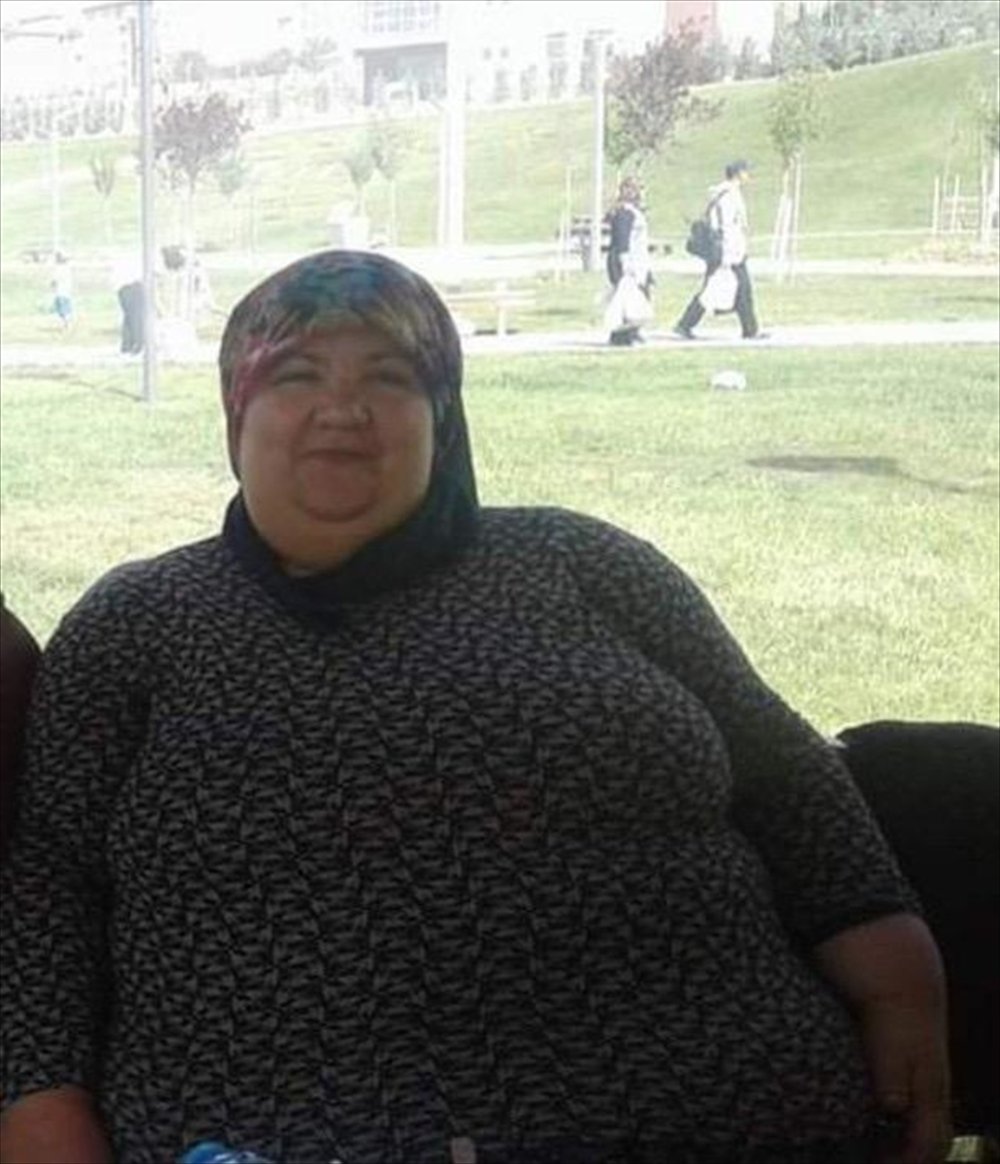 Aksaraylı Genç Kadın 95 Kilo Verdi