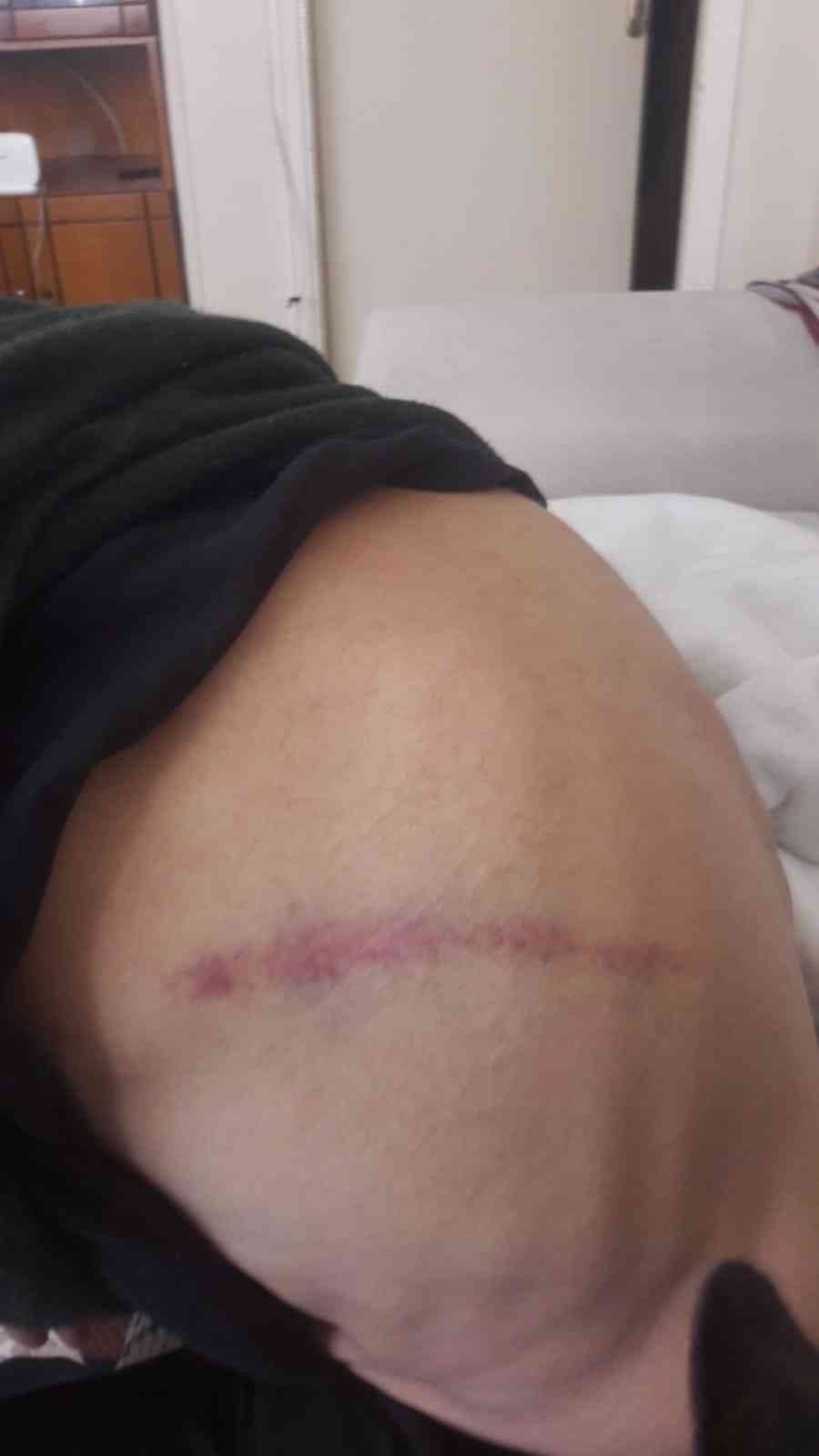 Eskişehir'den Seslenen Kadın Yardım Bekliyor