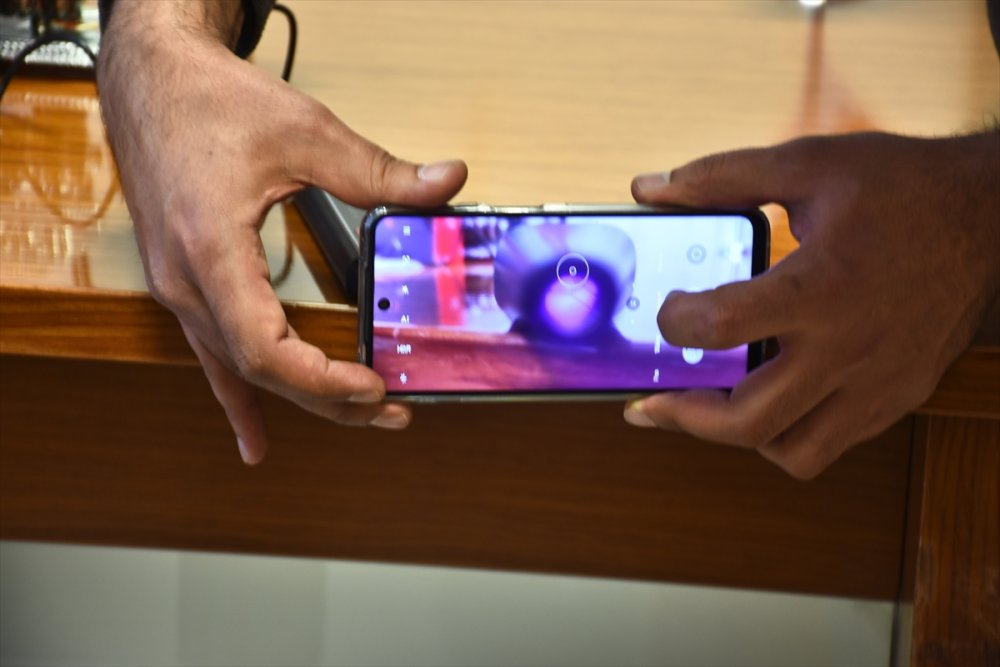 Türk Hekimlerinden İnsanlığa Hediye