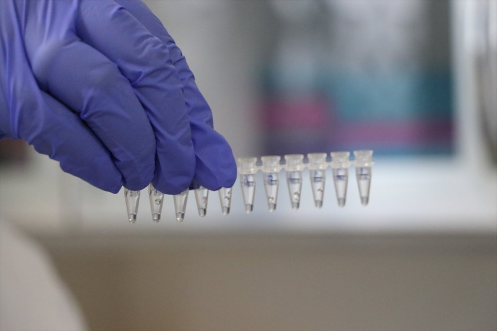 Niğde Patatesine Genetik Çalışma