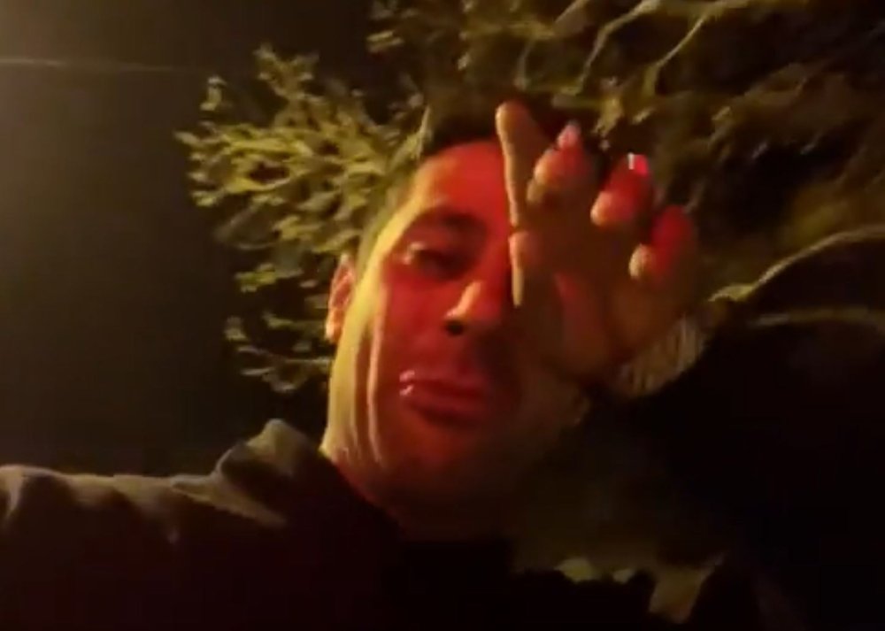 Antalya’da Köpek Gezdirme Kavgası