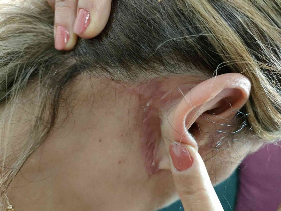 Güzelleşmeye Gitti, Estetik Mağduru Oldu