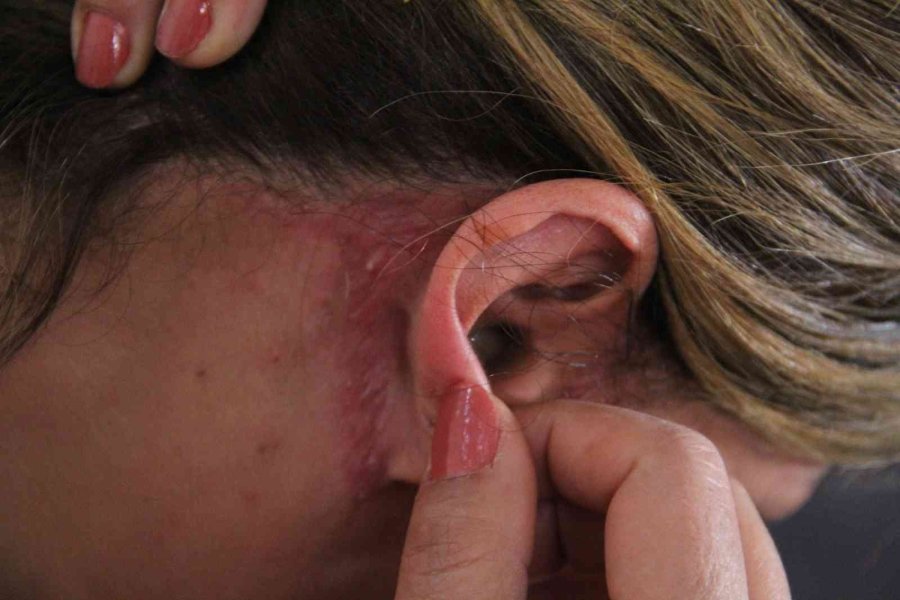 Güzelleşmeye Gitti, Estetik Mağduru Oldu