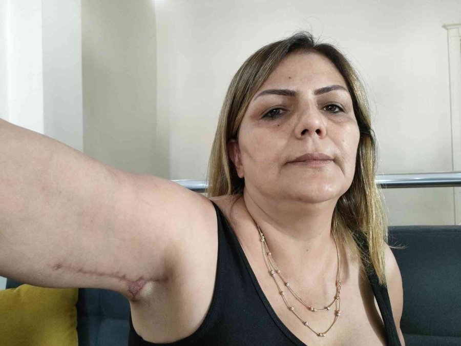 Güzelleşmeye Gitti, Estetik Mağduru Oldu