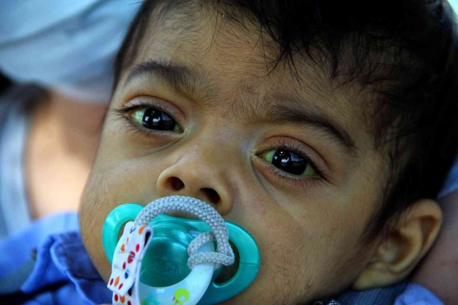 7 Aylık Minik Bulut’un Yaşam Mücadelesi