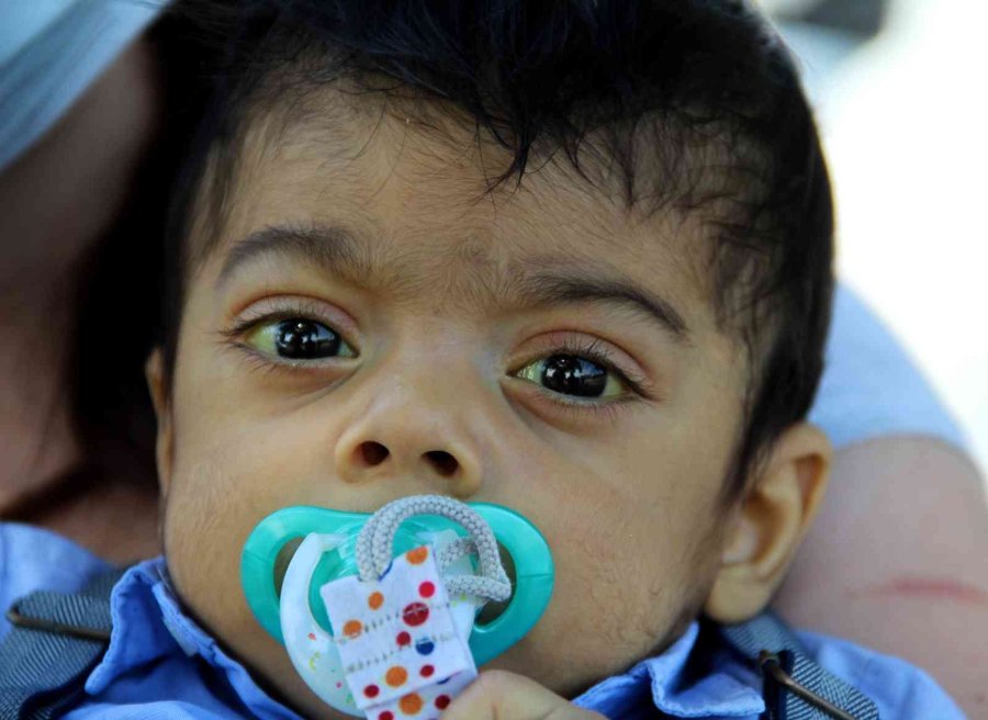 7 Aylık Minik Bulut’un Yaşam Mücadelesi