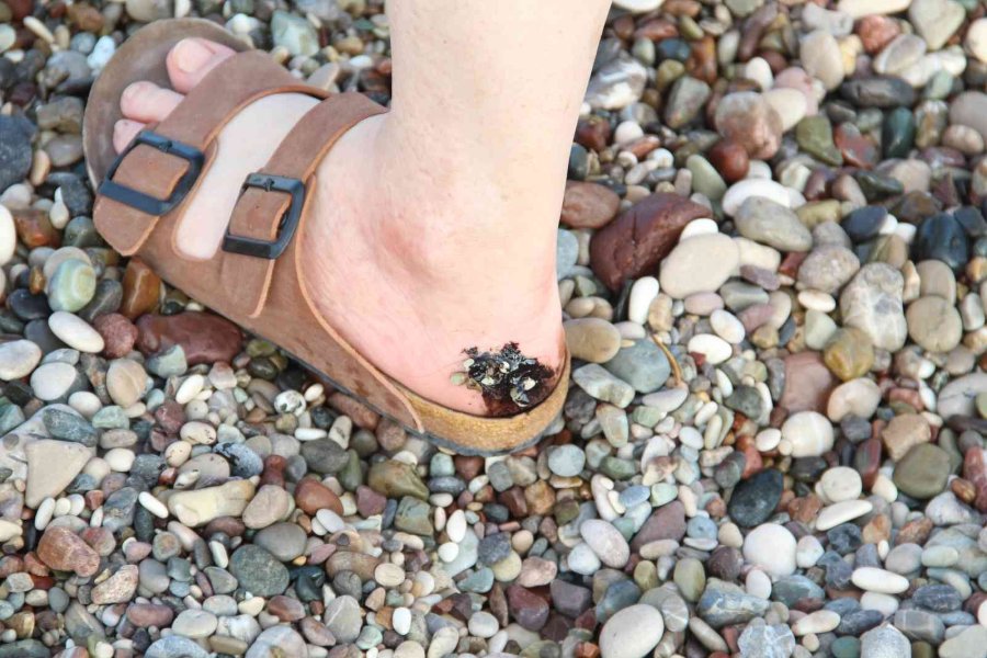 Konyaaltı Sahili’nde Denize Girenlerin Üstüne Zifti Andıran Bir Madde Yapıştı