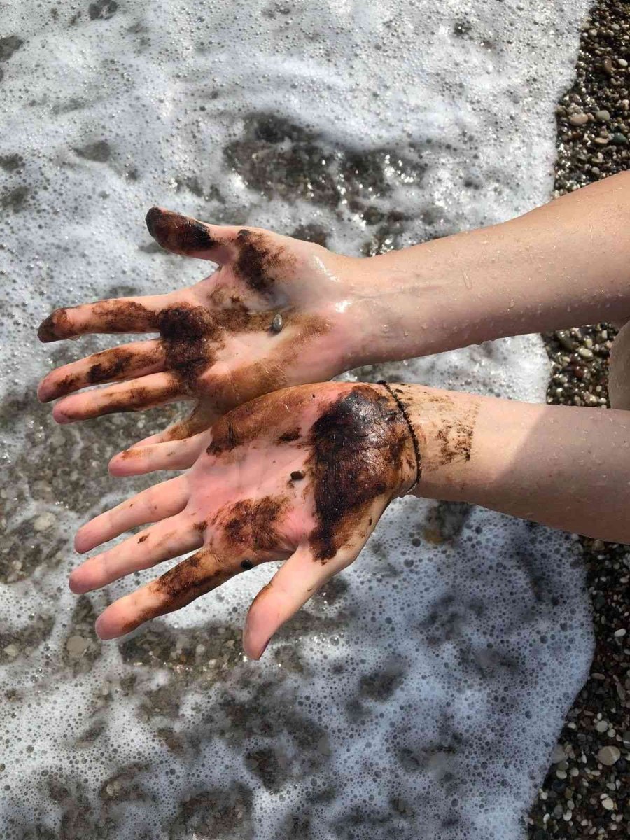 Konyaaltı Sahili’nde Denize Girenlerin Üstüne Zifti Andıran Bir Madde Yapıştı