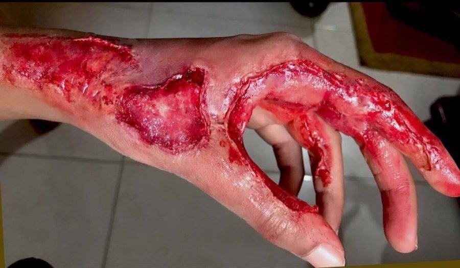 Bu Yaralar Gerçekten Farksız