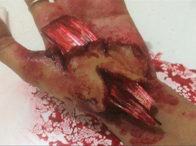 Bu Yaralar Gerçekten Farksız