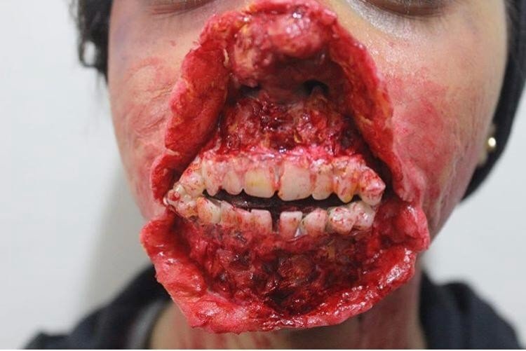 Bu Yaralar Gerçekten Farksız