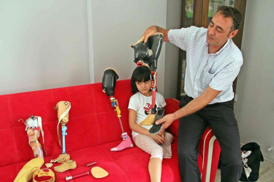 Onun Oyuncakları Protez Bacakları