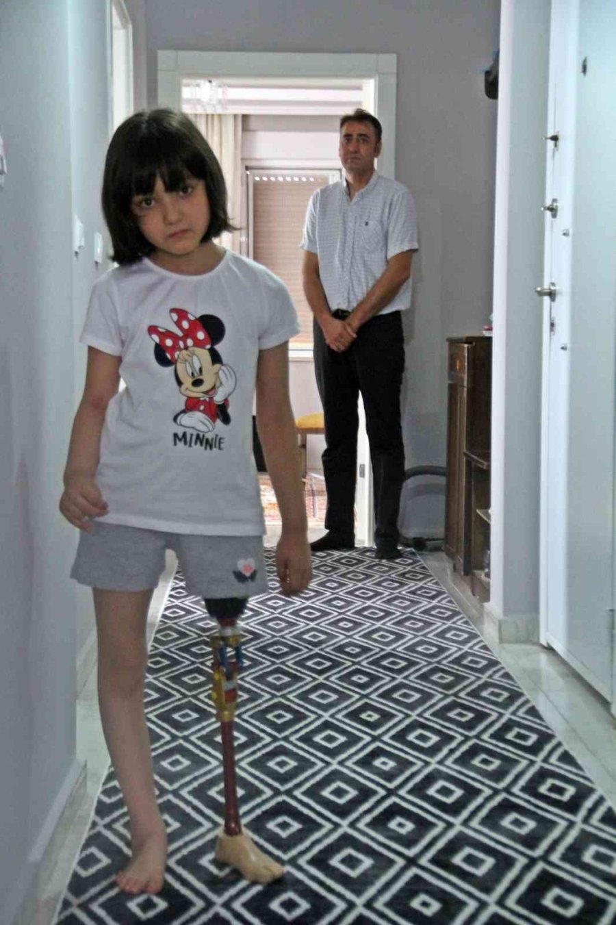 Onun Oyuncakları Protez Bacakları